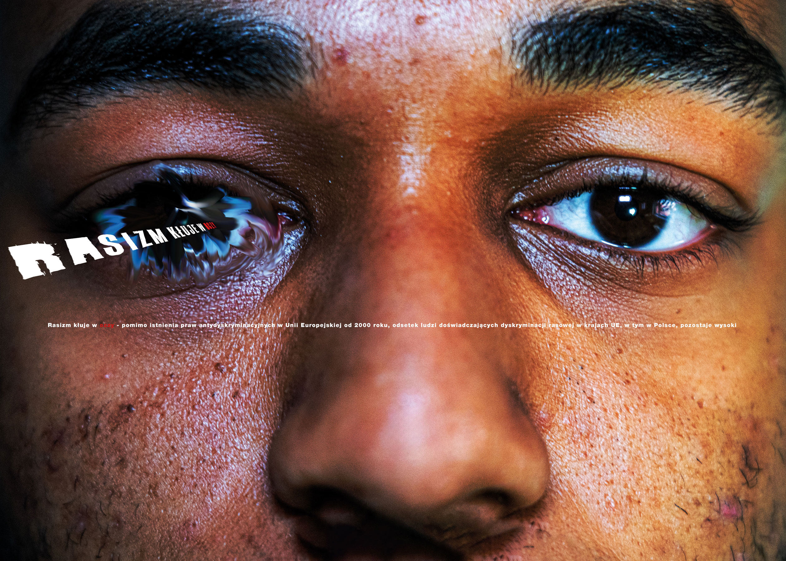 Kacper Michalak-Łukjanow — Rasizm kłuje w oczy